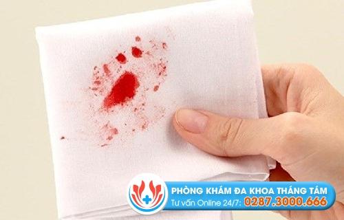 Những dấu hiệu bệnh trĩ thường gặp